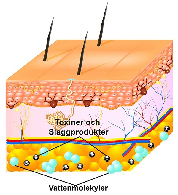 Detox with infrared slag products